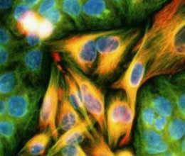 simple breath test could diagnose stomach cancer