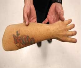 regenerate limbs