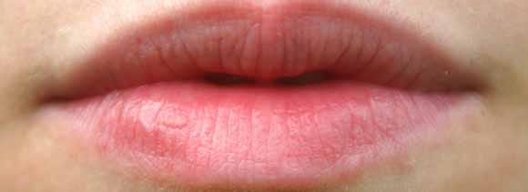remove cigarette spots with easy tips