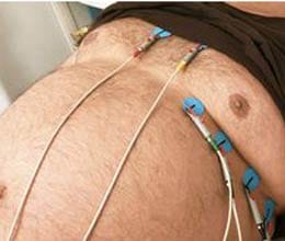 heart patients advantage being obese