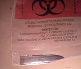 Man has  knife lodged in his back three years 