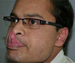 amit can touch his nose 100 times by tongue