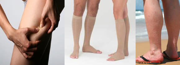 long standing leads up to varicose veins