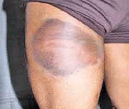 A new story of UP Police Cruelty, SO suspend
