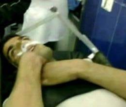 chemical weapons in syria 