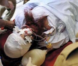 pakistani prisoner sanaullah condition extremely critical
