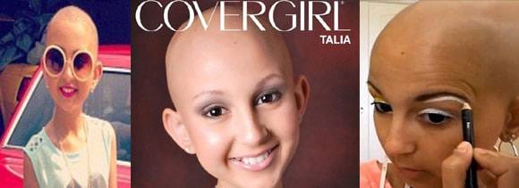 teenage cancer patient posed for covergirl