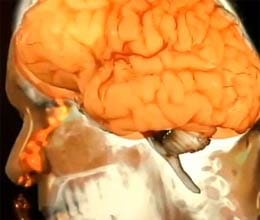 it was really his brain fluid leaking