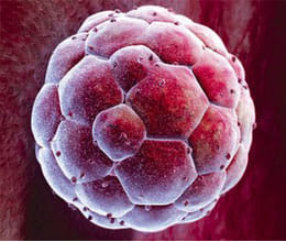 Cloning Is Used to Create Embryonic Stem Cells