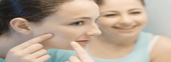blackheads removal remedies