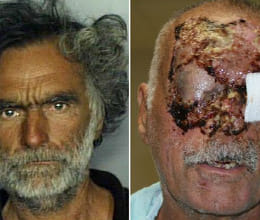 victim smiling again