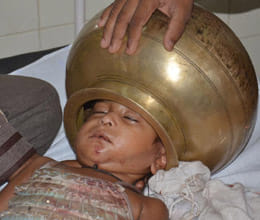 doctors failed to opreate this child 