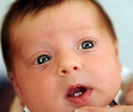 baby born with pair of bright white front teeth