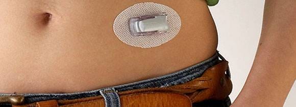 artificial pancreas to treat diabetes