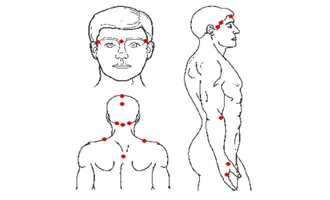 acupressure techniques for headache  