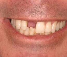 drunken polish dentist pulls tooth of patient