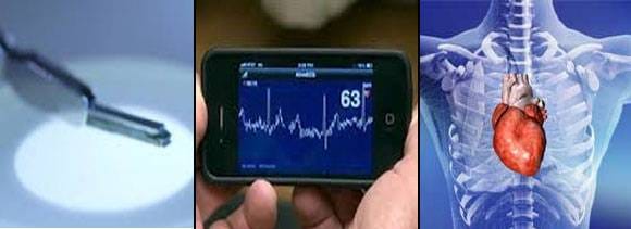 soon your smartphone would warn you for heart attack