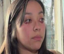 woman who cries blood
