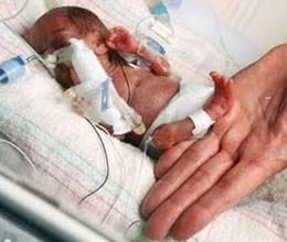 world's smallest baby