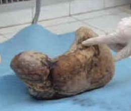 a woman who gave birth to a mummy
