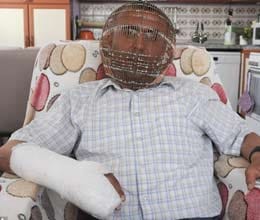man wears cage on his head to stop himself having cigarette