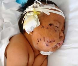 baby stabbed 90 times with scissors by his mother