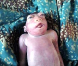 baby without brain in kaduna