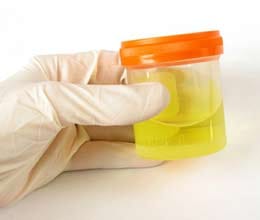 Scientists claim to power phone with urine
