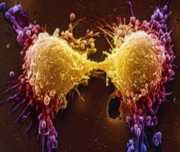 this knife will identity cancer tumor