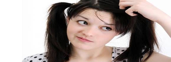 myths about dandruff