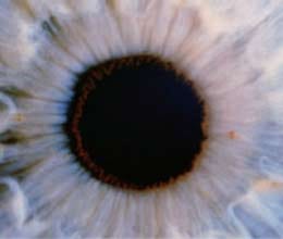 blindness stemcells 