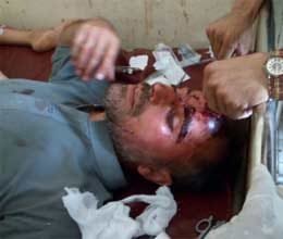two blasts in pakistan 25 killed