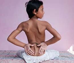 boy with growth tail
