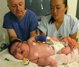 baby jasleen born at 13.47 pounds