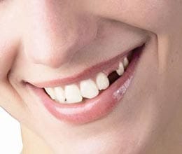 No birth certificate only Teeth show and entry