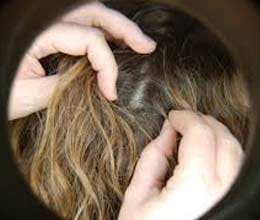 Mother arrested after setting her daughter on fire to treat her head lice