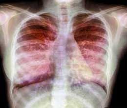 bug whelped in lungs because of dirty vegetables