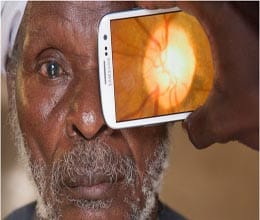 glaucoma-mobileapp-southafrica