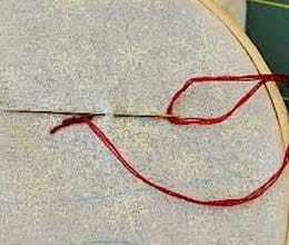 needle removed from uterus after 20 years