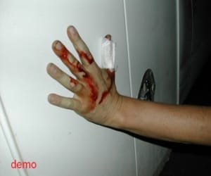 leader cut Hand with a sickle on pointed the finger 