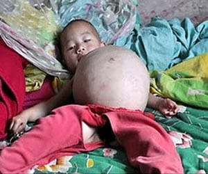 1 year old girl gets pregnant