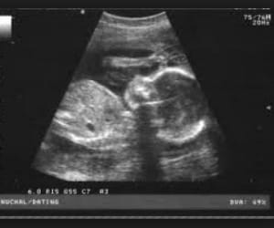 Bad Management for Ultrasound Facility in Govt Medical Institutes, Chandigarh