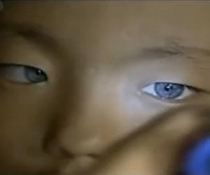 Awareness necessary for the prevention of uveitis