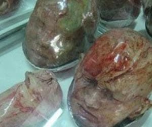 market where human parts sold