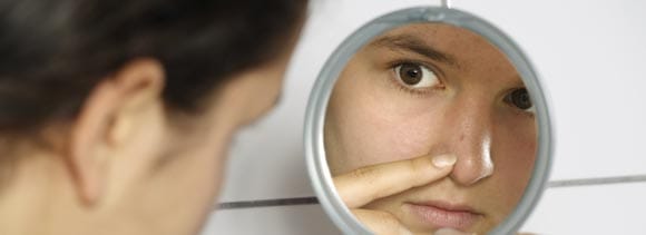  causes of pimples in teenage and prevention