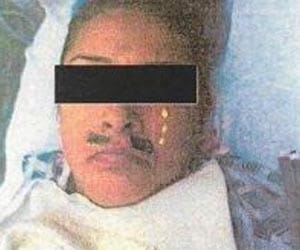 Woman wakes up with mustache after surgery