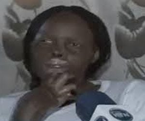 Man burns his wife for being too beautiful 