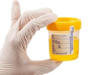 using fake penis to beat doping test
