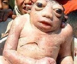 Frogs Sperm makes woman pregnant