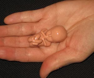 strange birth